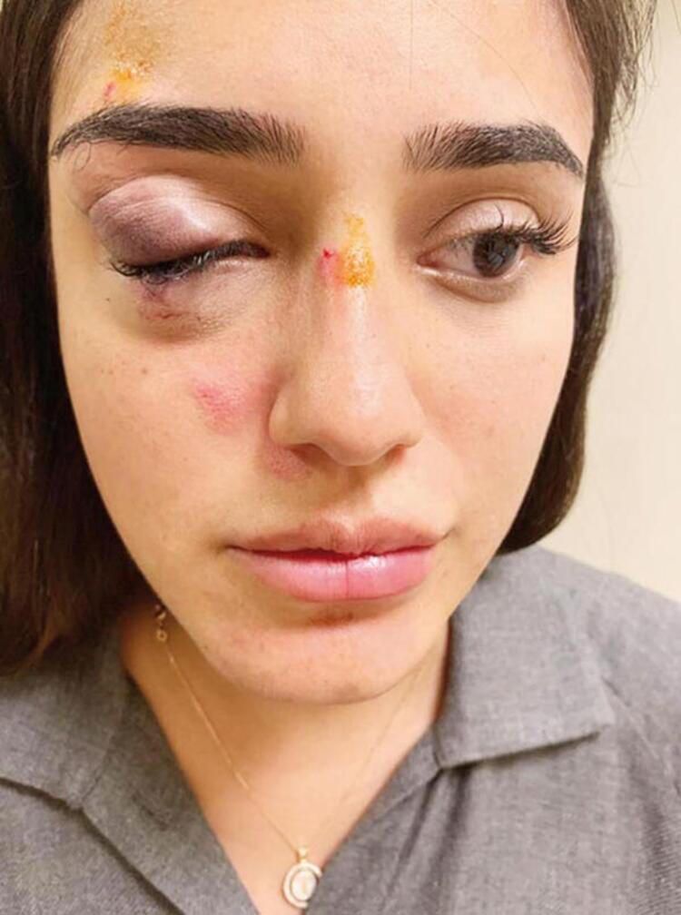 Hamileyken şiddet görmüştü... Ceren Kaplakarslan anne oldu! - Sayfa:2
