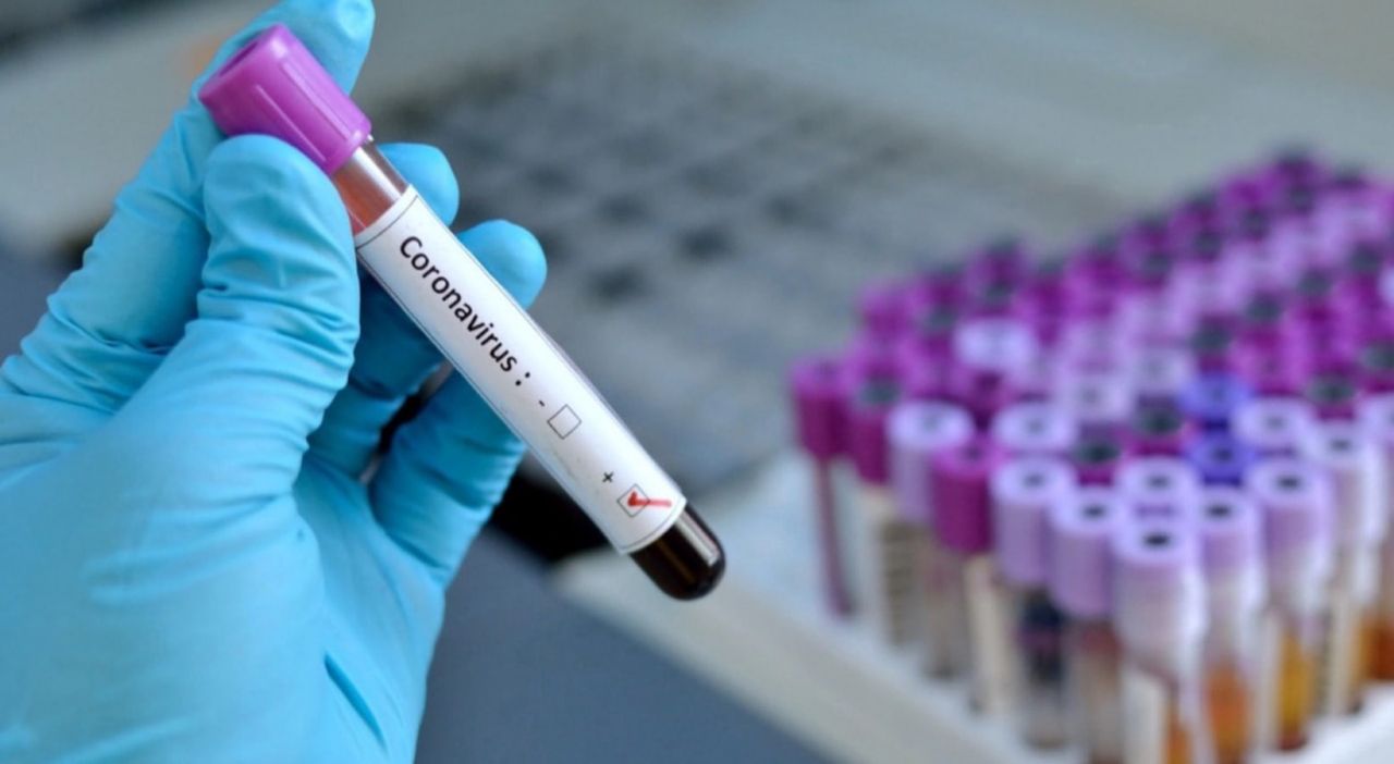 Bilim Kurulu Üyesi Kara'dan çok kritik Coronavirus uyarısı: 'Pazara kadar evde kalın!' - Sayfa:1