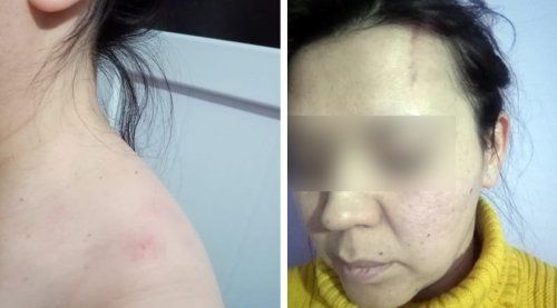 Darp skandalında Seren Serengil hakkında şok karar - Sayfa:3