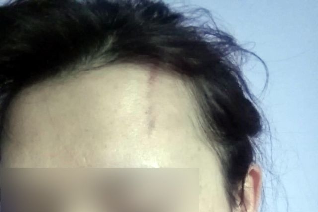 Darp skandalında Seren Serengil hakkında şok karar - Sayfa:2