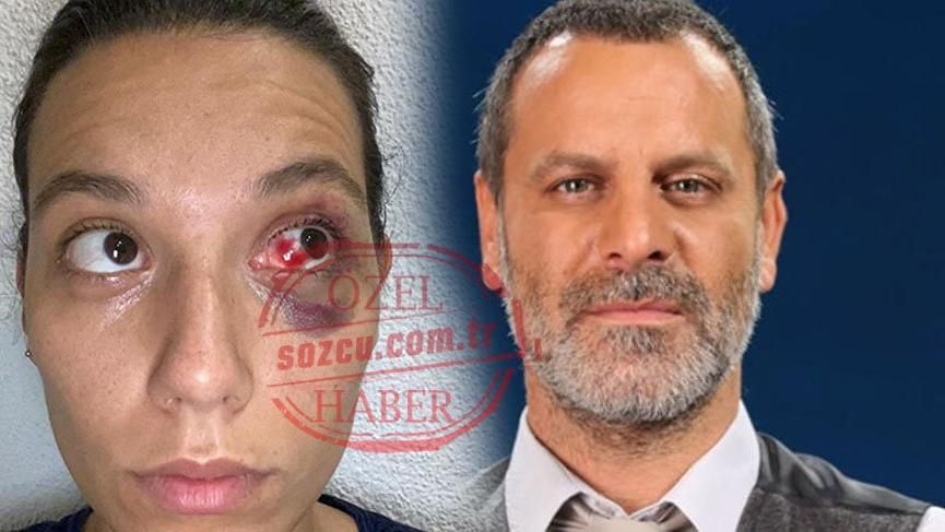 Ozan Güven ve Deniz Bulutsuz kavgasının detayları! - Sayfa:2