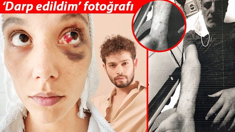 Ozan Güven - Deniz Bulutsuz olayında ilk tanık ifadesi: Evime geldi üstü kandı! - Sayfa:2