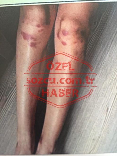 Ozan Güven’in darbettiği Deniz Bulutsuz’un yeni fotoğrafları ortaya çıktı! - Sayfa:4