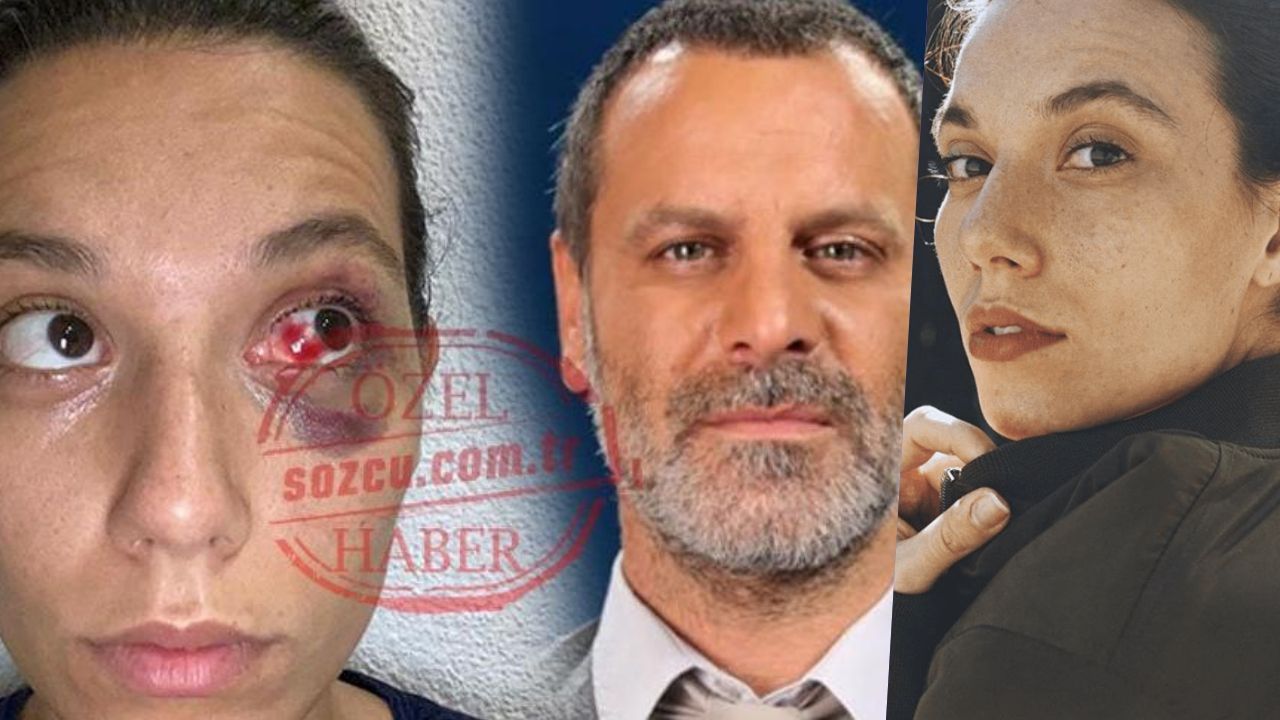 O gecenin kamera kayıtları ortaya çıktı! Deniz Bulutsuz çıplak ayakla sokakta - Sayfa:4