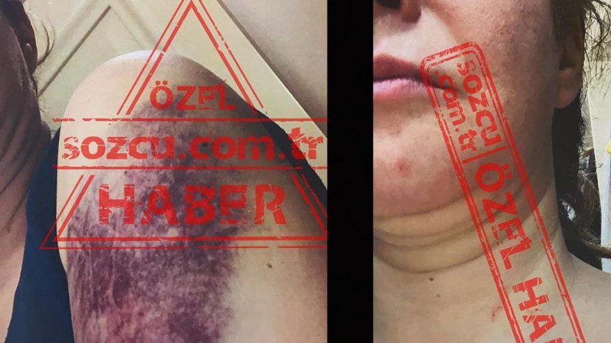Tansu Çiller'in oğlu Mert Çiller’e boşanma davası açan eşi: Kafamı duvardan duvara vurdu, kaburgalarımı kırdı - Sayfa:1