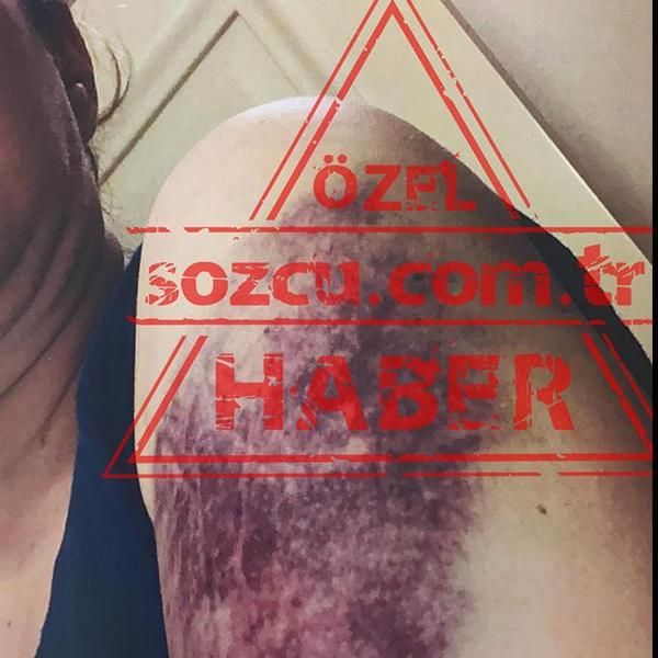 Tansu Çiller'in oğlu Mert Çiller’e boşanma davası açan eşi: Kafamı duvardan duvara vurdu, kaburgalarımı kırdı - Sayfa:2
