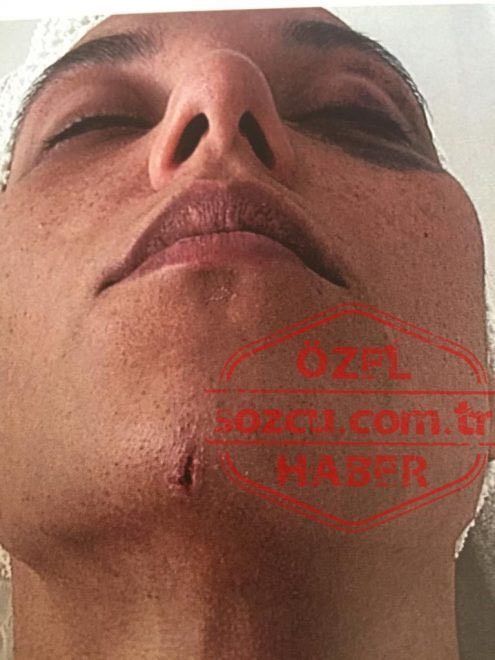 Ozan Güven - Deniz Bulutsuz davasında flaş gelişme! - Sayfa:4