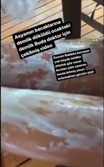 Korkunç kaza! Yeliz Yeşilmen ağlayarak anlattı - Sayfa:2