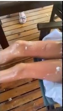 Korkunç kaza! Yeliz Yeşilmen ağlayarak anlattı - Sayfa:4