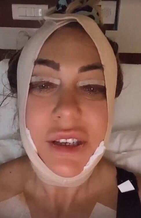 Yeliz Yeşilmen estetik operasyonu geçirdi: 'Hem para veriyorsunuz, hem acı çekiyorsunuz’ - Sayfa:2