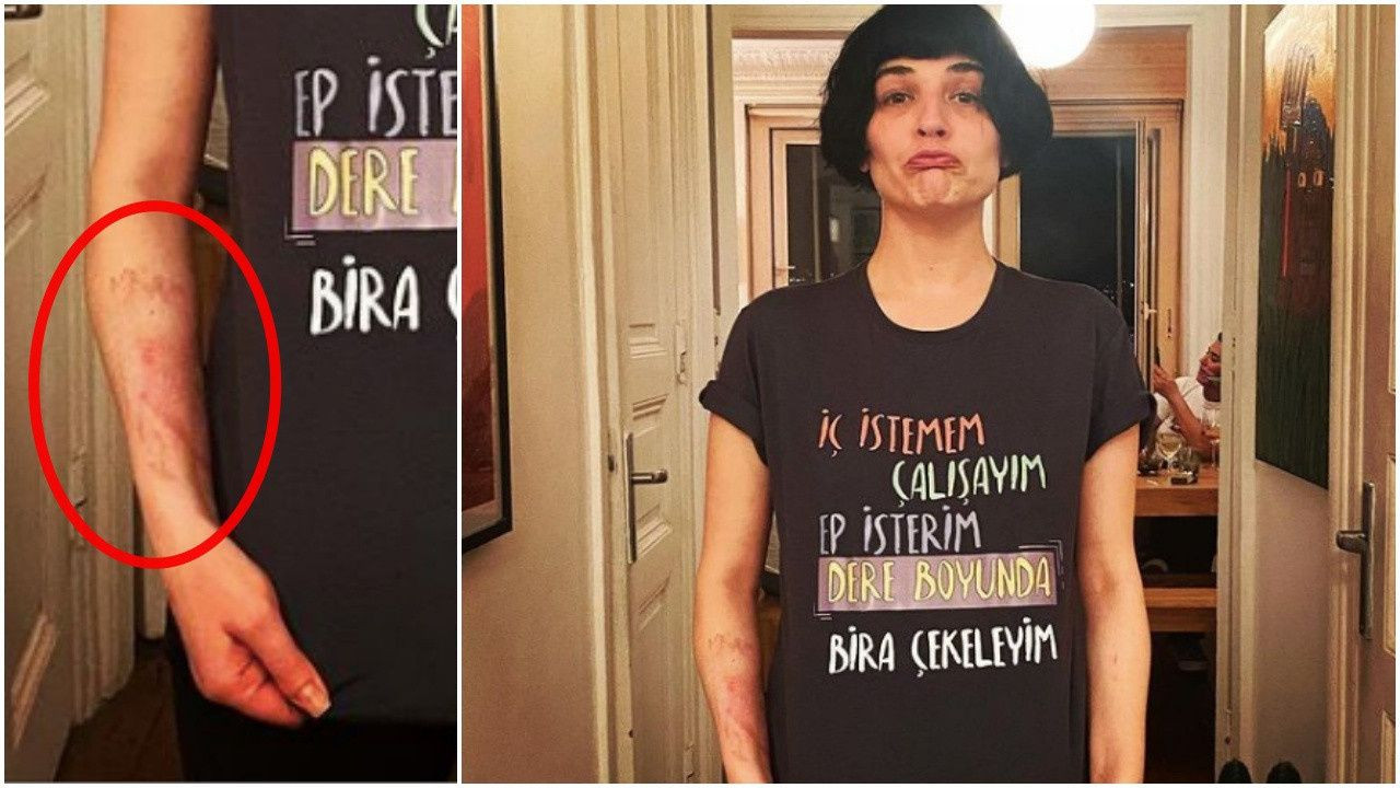 Corona'ya yakalanan Gonca Vuslateri'den bir kötü haber daha: "İstanbul’u ayağa kaldırdım çığlıklarımla" - Sayfa:3