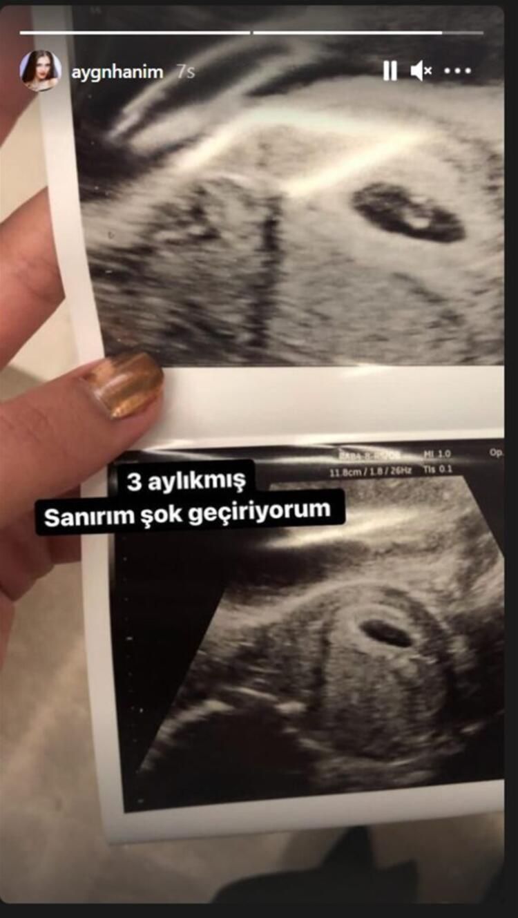 Hakan Sabancı ile aşk yaşadığını iddia eden Aygün Aydın hamile mi? Ultrason görüntüsünü paylaştı - Sayfa:2