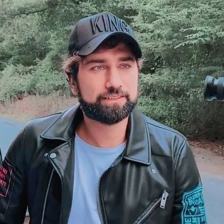 Estetik ameliyatı olmuştu... Yasin Obuz değişimiyle görenleri şoke etti! - Sayfa:2