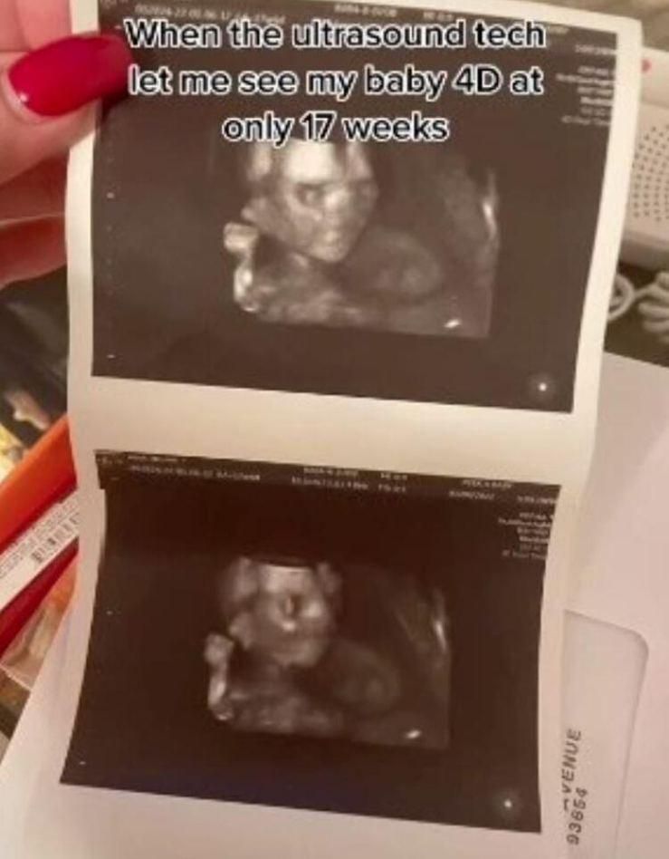 Hamile kadının ultrason görüntüsü dehşete düşürdü! - Sayfa:4